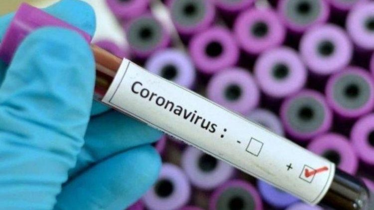 cropped-coronavirus-cile.jpg