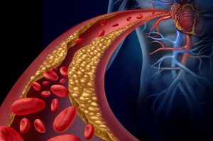 ThinkstockPhotos-498686795.blood-vessel.two_-600x397-1.jpg