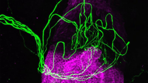 Un follicolo pilifero, evidenziato in viola, circondato da nervi sensoriali in verde.