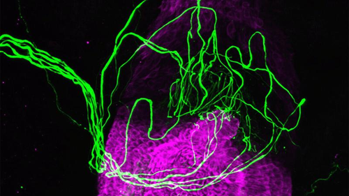 Un follicolo pilifero, evidenziato in viola, circondato da nervi sensoriali in verde.