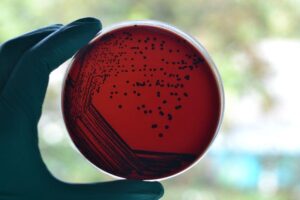 petri-dish-with-corynebacterium-m.jpg