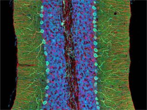 cerebellum-m.jpg