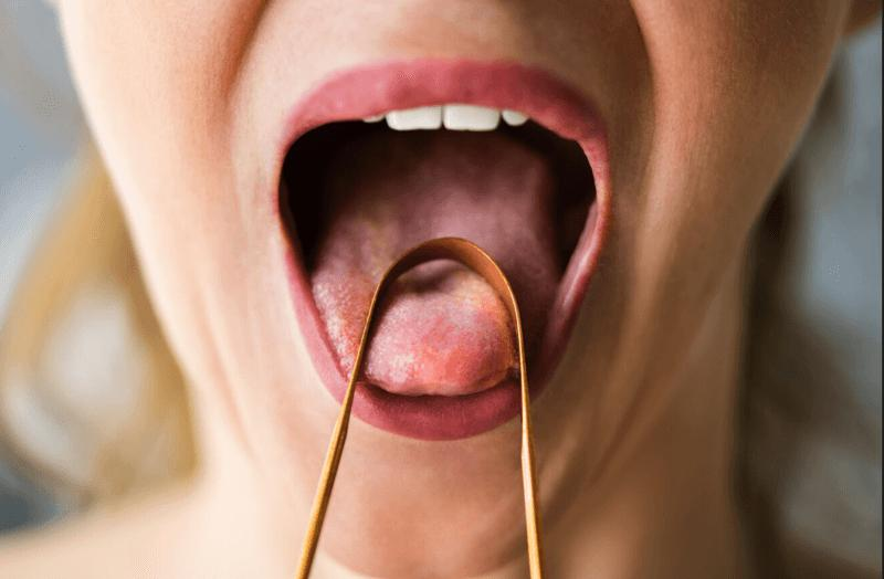 tongue-m-1.png