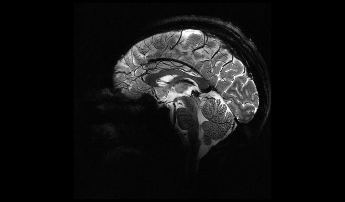 brain-m-1.jpg