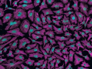 cervical-cancer-cells-m.jpg