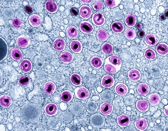 Micrografia elettronica a trasmissione di particelle di citomegalovirus (CMV) (viola) trovate all'interno di vescicole intracellulari di un macrofago infetto (blu)