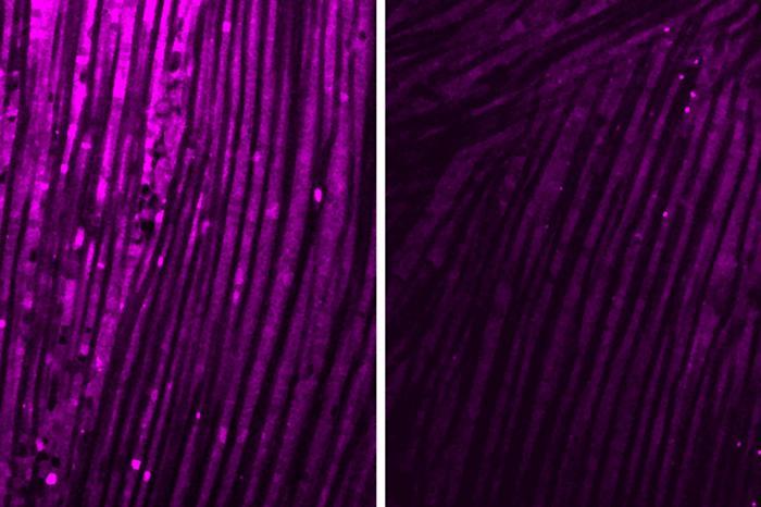 due immagini di fibre muscolari colorate di viola al microscopio; quelle a sinistra sono molto più intensamente colorate