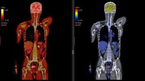 pet-ct-scan-m.jpg