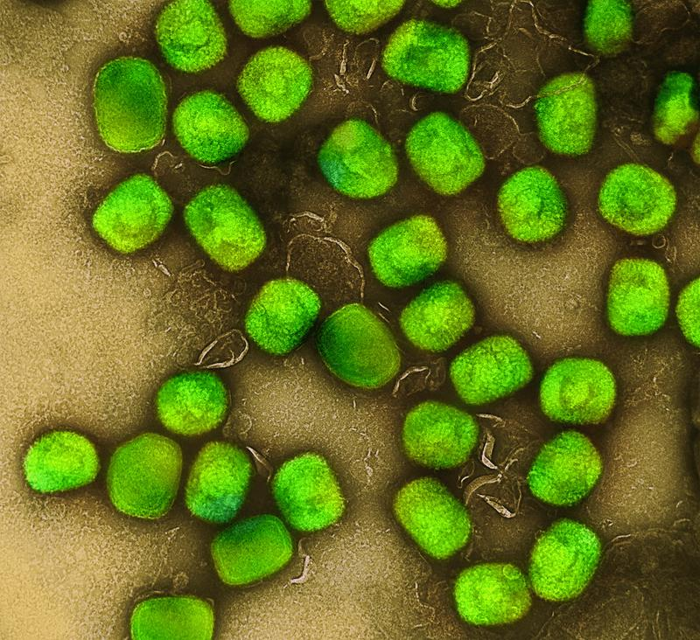 immagine microscopica elettronica a trasmissione colorizzata di particelle di virus mpox (verde) che erano state coltivate e purificate da colture cellulari. 