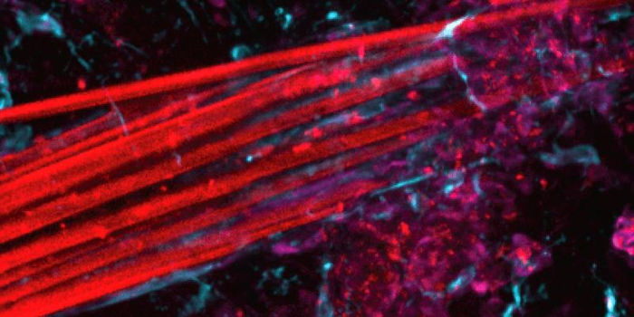 immagine al microscopio che mostra il fascio di fibre dell'elettrodo in rosso