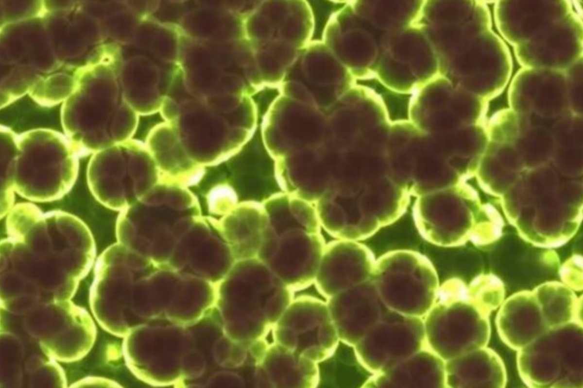 Candida auris, nuovo ceppo del fungo scoperto