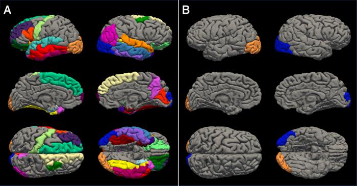 La foto mostra due serie di scansioni cerebrali. A sinistra ci sono sei visualizzazioni di cervelli femminili con regioni colorate diverse, mentre i sei cervelli a destra mostrano cervelli maschili. La distribuzione del colore sui cervelli femminili copre più angoli, mentre i cervelli maschili hanno solo due punti colorati sul retro.