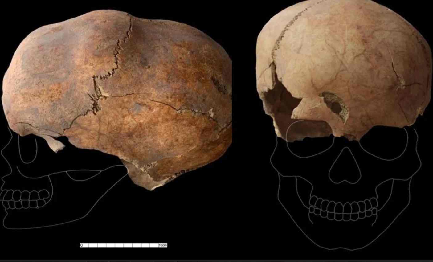 Scoperto un teschio di 6000 anni in Turchia