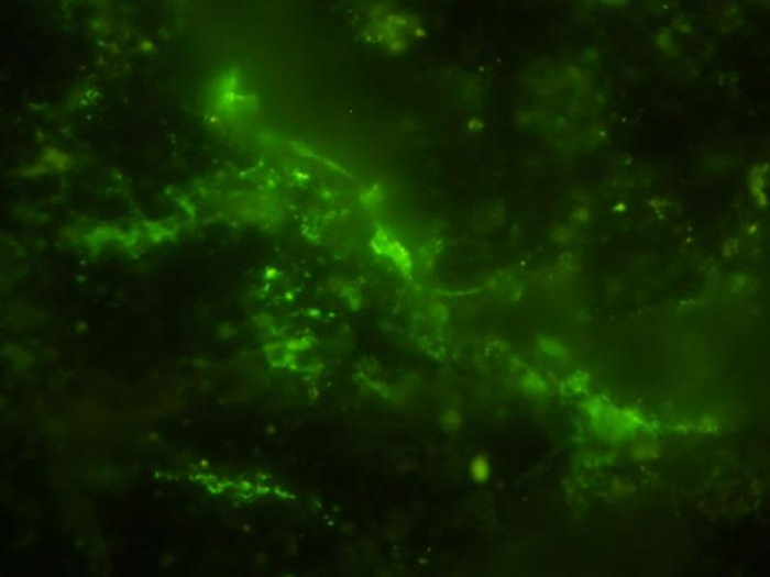 ancient-microbial-cells-stained-green-m-1.png