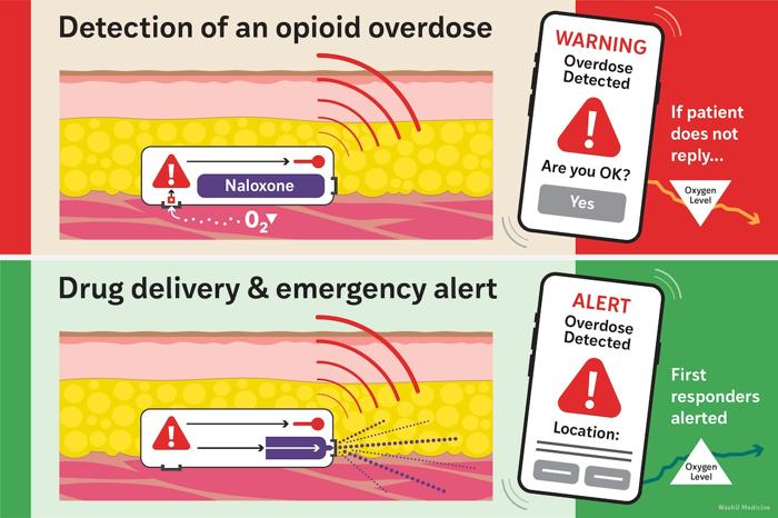 Diagramma che mostra come il Naloximeter rileva bassi livelli di ossigeno, invia un avviso al telefono della persona e quindi somministra naloxone e avvisa i servizi di emergenza se la persona non risponde all'avviso