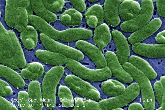 Sotto un'alta ingrandimento di 13184X, questa immagine al microscopio elettronico a scansione (SEM) digitalmente colorata mostra un gruppo di batteri Vibrio vulnificus.