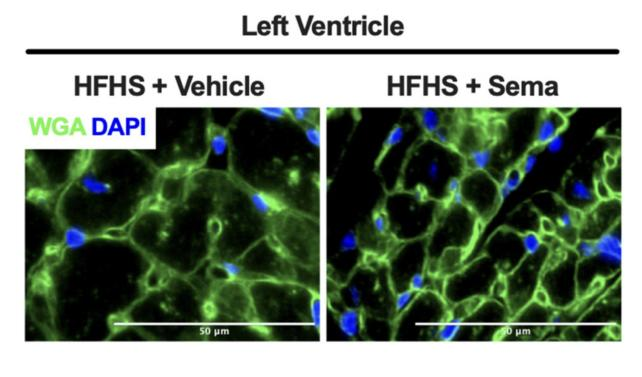 Cardiomiociti Semaglutide
