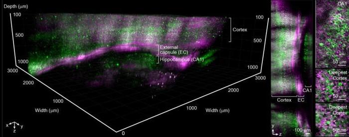 Imaging In Vivo di Mouse Brain Structures Deep and Large Field of View