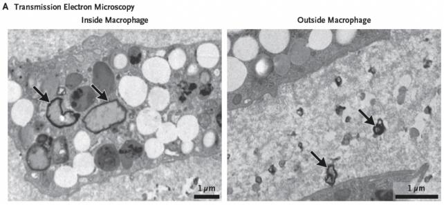 Pannello di due immagini in bianco e nero che mostrano particelle di plastica frastagliate, contrassegnate con frecce, in sezioni di tessuto, viste al microscopio.