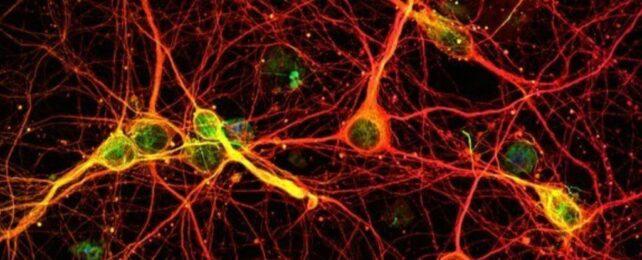 Immagine al microscopio di neuroni prelevati dal cortex di un topo colorati in rosso, giallo e verde