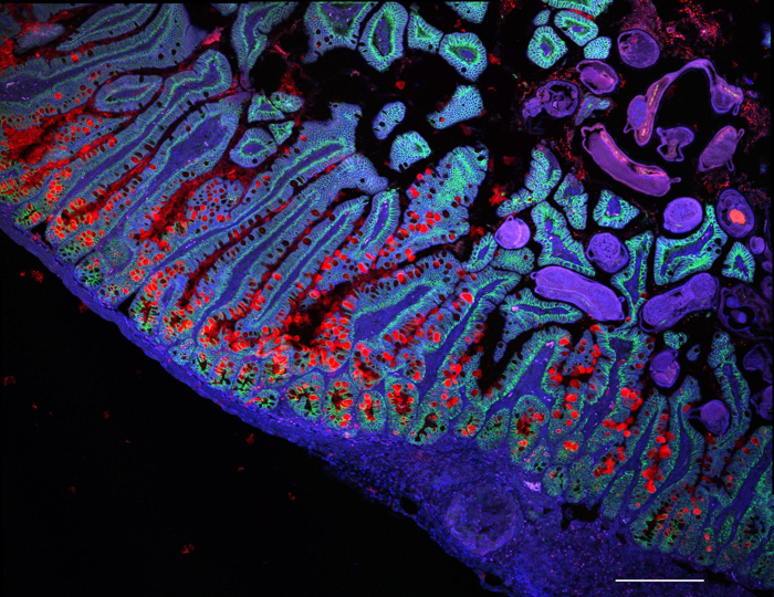 immagine al microscopio di un pezzo di piccolo intestino umano, colorato in tonalità di blu, viola, rosso e verde