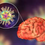 Herpes Simplex Virus 1: Implications for Brain Health