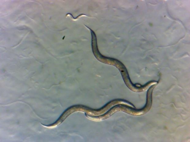 Nematodi sotto un microscopio