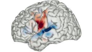 Il mappaggio cerebrale avanza la comprensione del linguaggio umano e delle allucinazioni nella schizofrenia