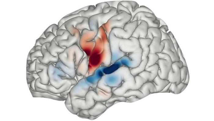 Brain-Mapping-Human-Speech-Hallucinations-Schizophrenia-777x440-1.jpg