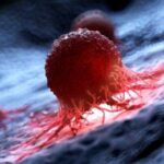 La rivoluzionaria tecnica per combattere il cancro a livello molecolare