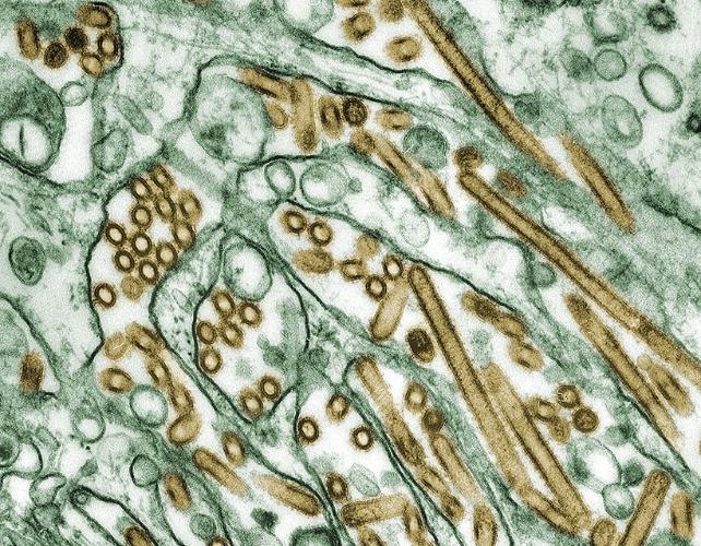 Micrografia elettronica a trasmissione colorata di virus dell'influenza aviaria A H5N1