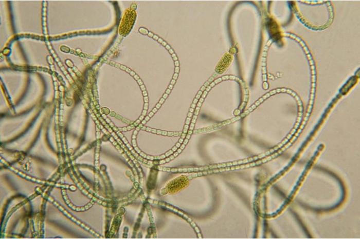 Cyanobacteria-1-777x518-1.jpg