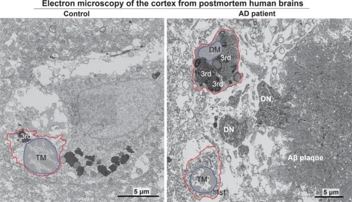 Microglia scure