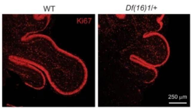 Immagine al microscopio che mostra lobi cerebrali più grandi nell'immagine di sinistra rispetto a quella di destra