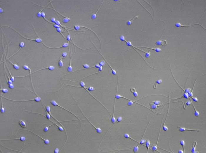 Microscopia a fluorescenza dello sperma umano