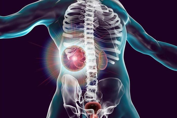Kidney-Cancer-Treatment-Concept-777x518-1-1.jpg