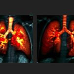 Scoperta rivoluzionaria: Imaging polmonare in tempo reale