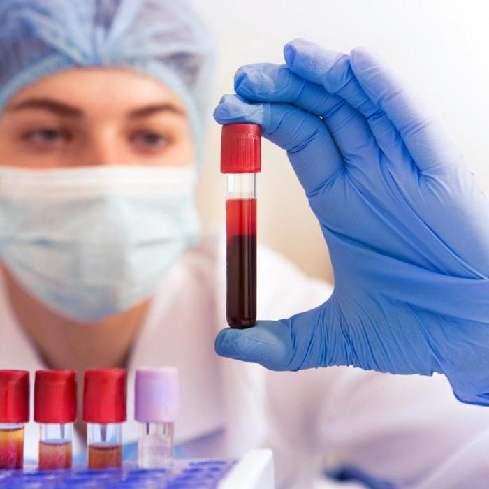 Medical-Blood-Test-Tubes-777x777-1-1.jpg