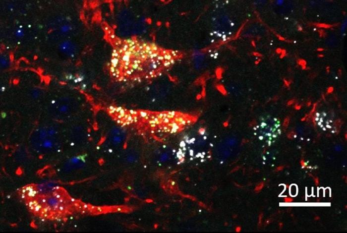 Neuroni del Mesencefalo che Coesprimono il Recettore Mu degli Oppioidi e il Recettore Cannabinoidi 1