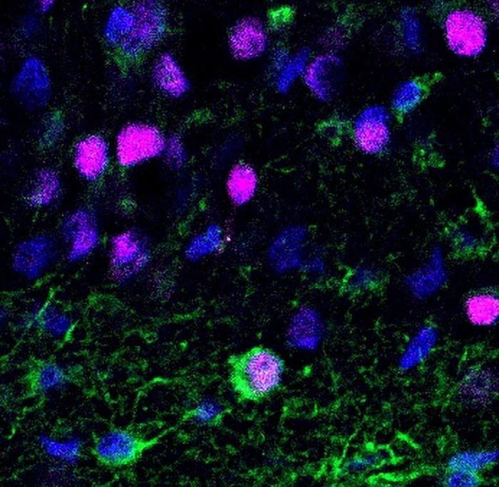 Neurone Neonato nel Tessuto Cerebrale Adulto