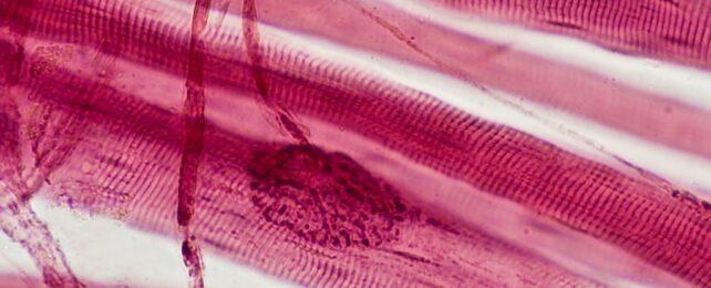 Fibre muscolari striate rosa con connessioni nervose blobby