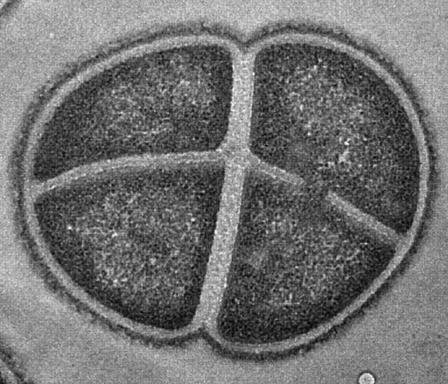 micrografia di d radiodurans