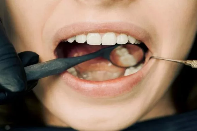 magnifying-glass-and-teeth-680x453-1.webp