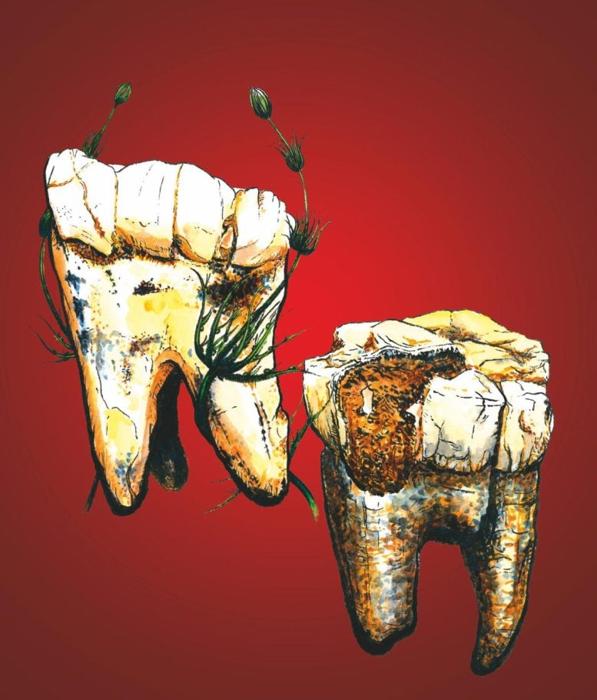 Australopithecus-Molars-777x910-1-1.jpg