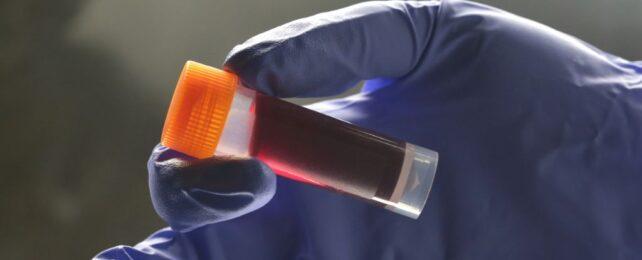 EndoBloodTest-642x260-1-1.jpg