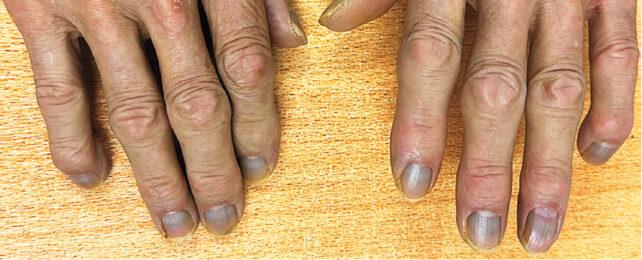 fingernails_silver_header-642x260-1.jpg