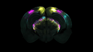 Sezione coronale del cervello che mostra le proiezioni da diverse aree visive nella corteccia cerebrale al nucleo genicolato ventrolaterale (vLGN). Questi percorsi fanno parte del circuito identificato come mediando la soppressione delle risposte istintive di paura.