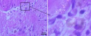 immagine al microscopio di nanoparticelle di plastica nel tessuto cerebrale